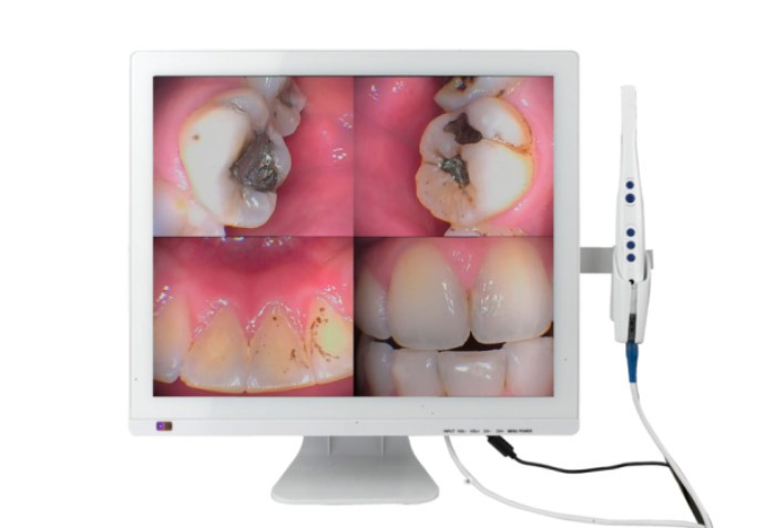 Caméra Intra-orale Dentaire Avec écran LCD - Moniteur Intégré, Pour Diagnostic Dentaire, Neuve