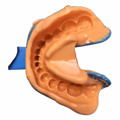 NEOENDO NeoAlgin (Alginate Impression Material) - ORAL HEALTHCART